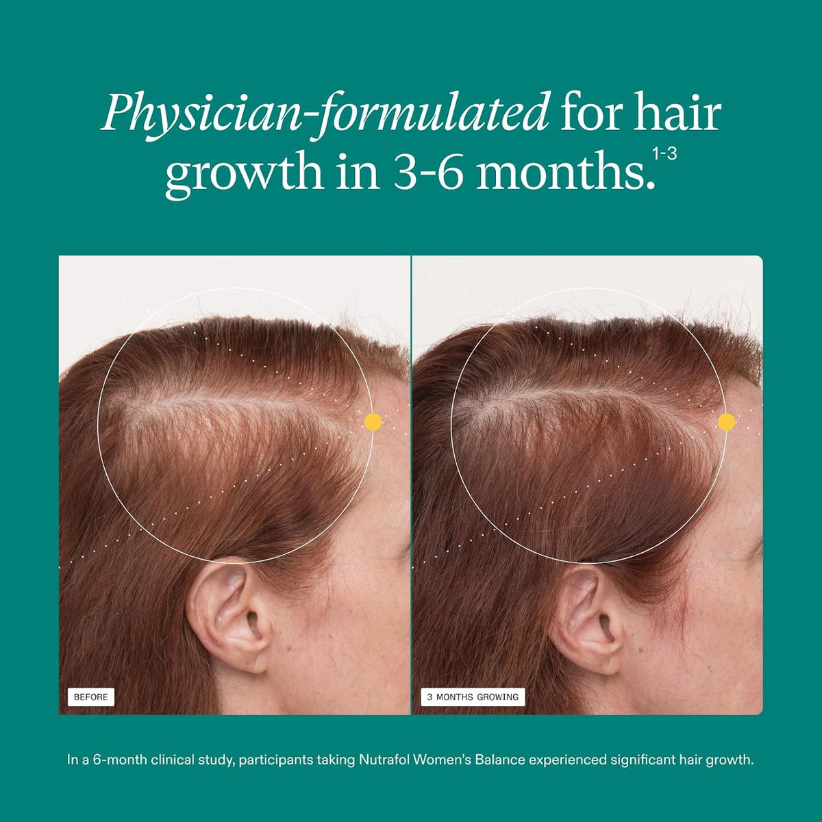 Women's Balance Hair Growth Supplements, Ages 45 and Up, Clinically Tested for Visibly Thicker Hair and Scalp Coverage, Dermatologist Recommended - 1 Month Supply