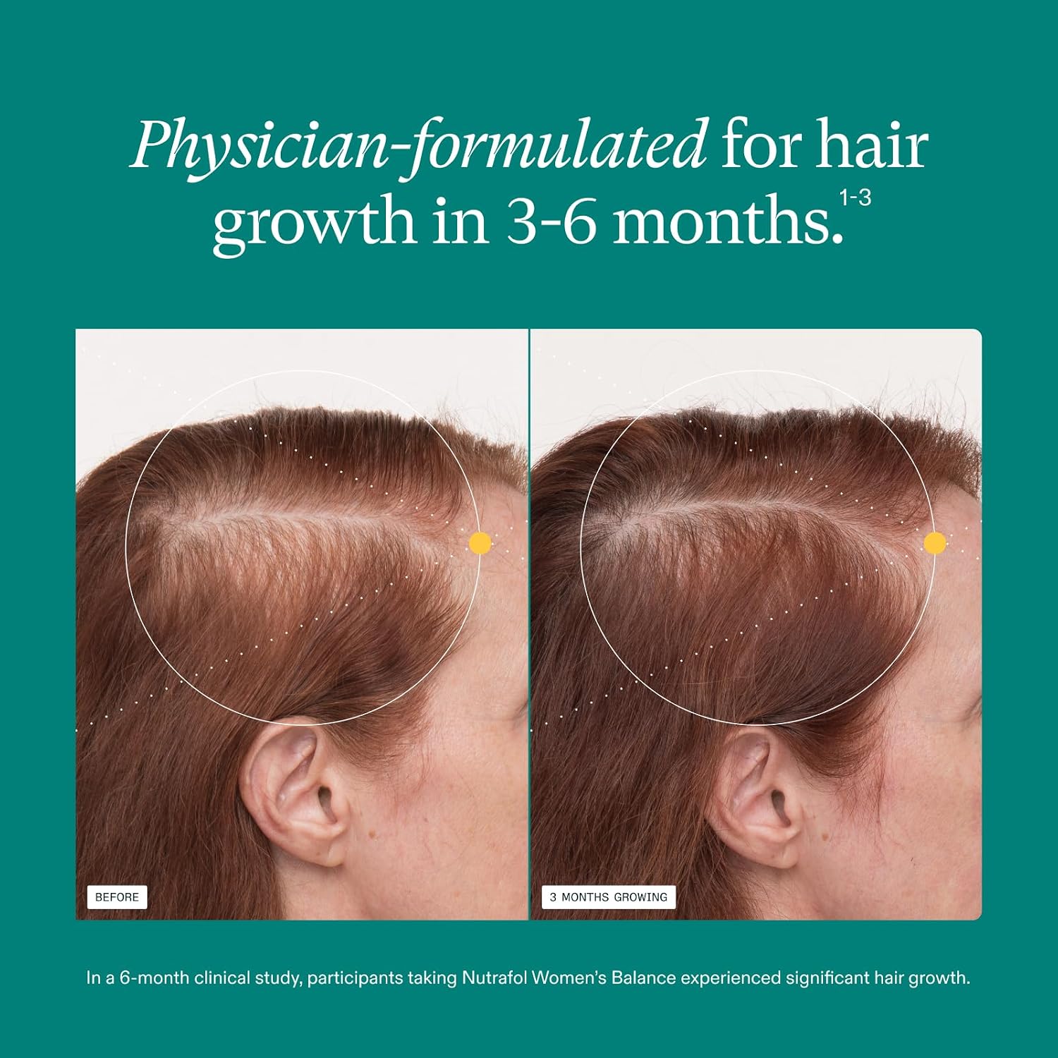 Women's Balance Hair Growth Supplements, Ages 45 and Up, Clinically Tested for Visibly Thicker Hair and Scalp Coverage, Dermatologist Recommended - 1 Month Supply